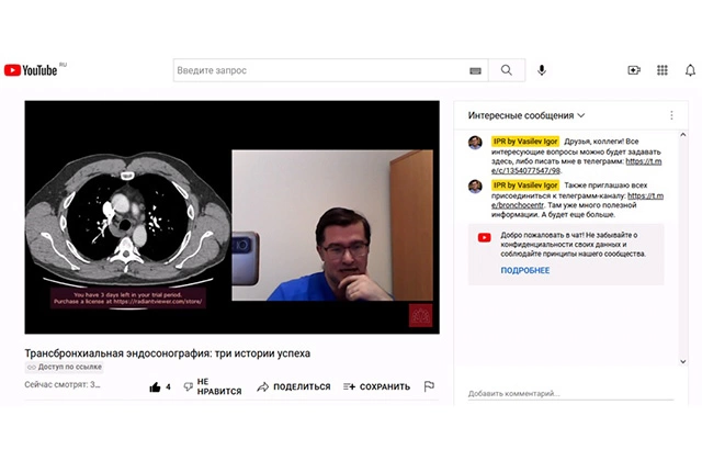 скрин-1.jpg Вебинар «Трансбронхиальная эндосонография: три случая успеха»